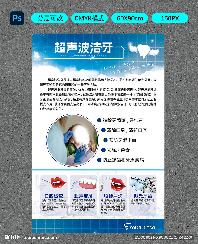 超声波洁牙