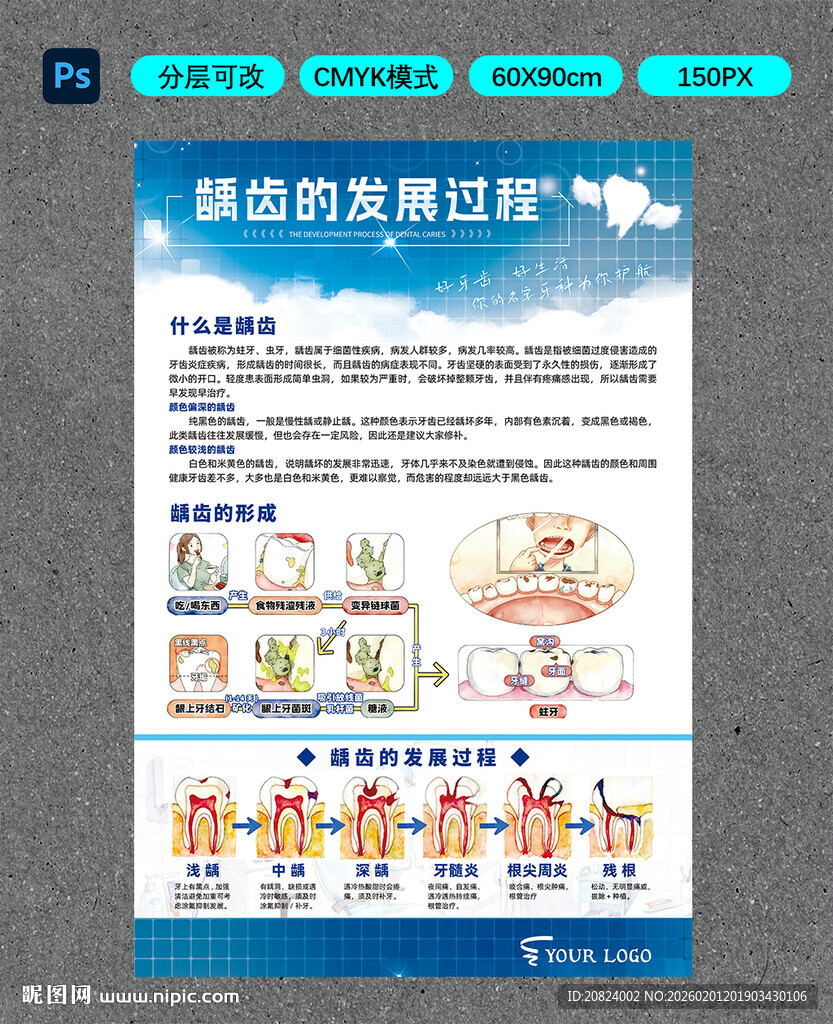 龋齿的发展过程