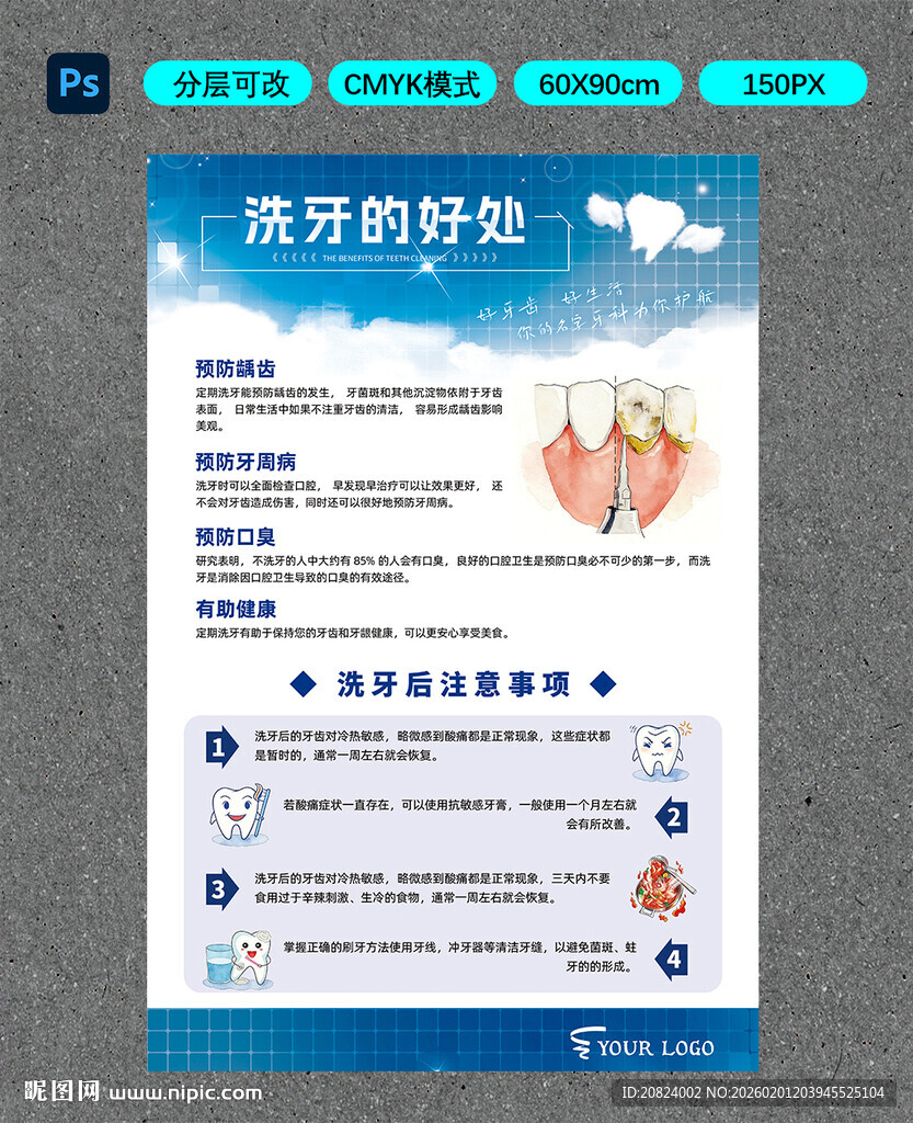 洗牙的好处介绍