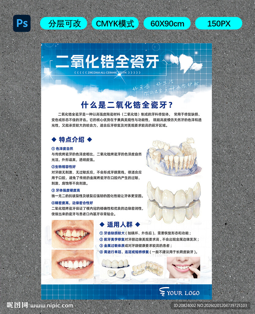 二氧化锆全瓷牙介绍