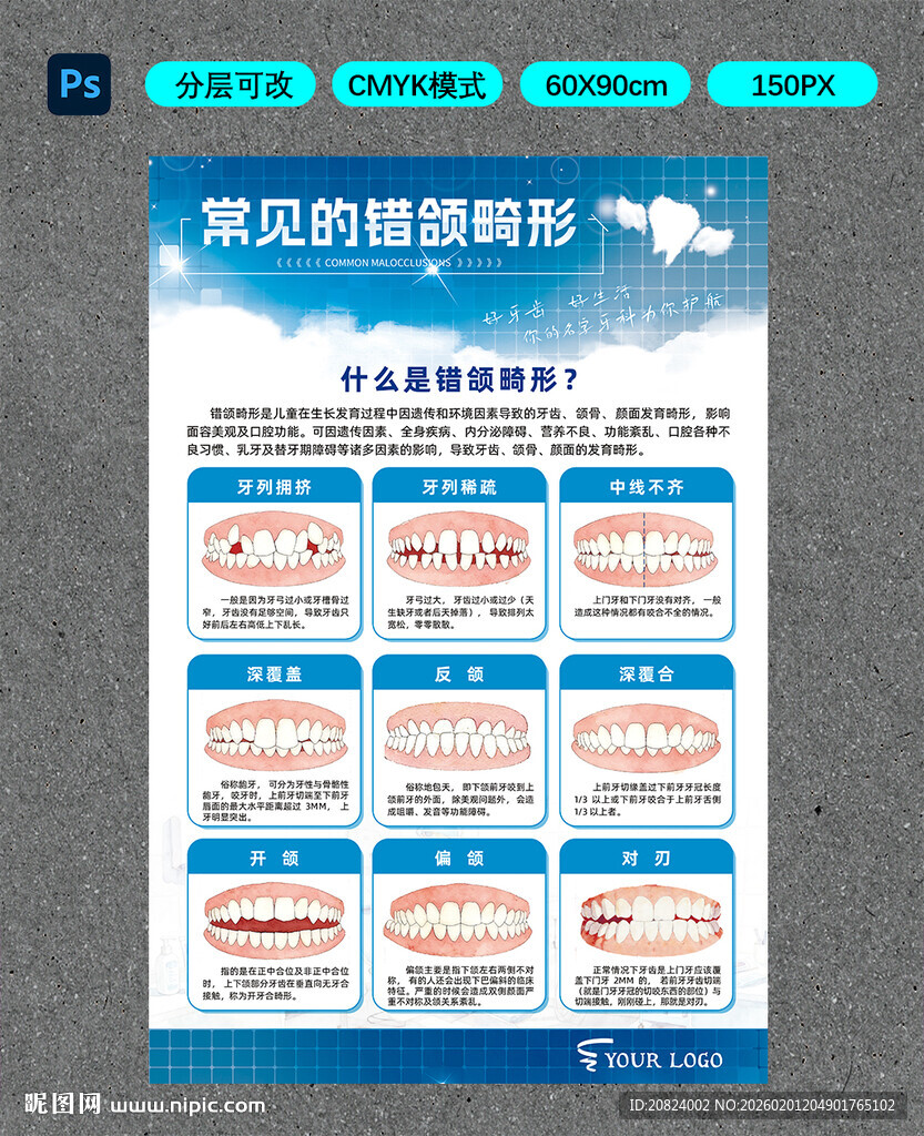 常见错颌畸形类型展示