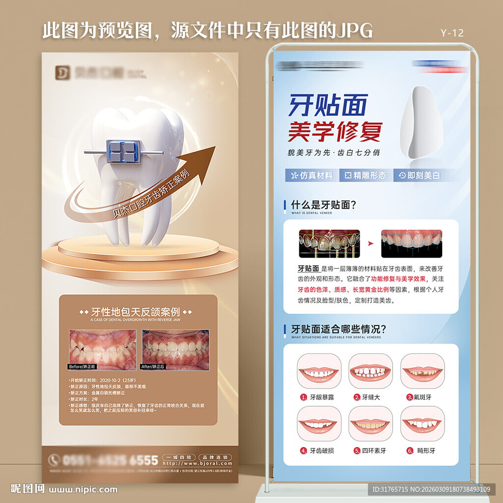 牙科口腔牙齿矫正展架