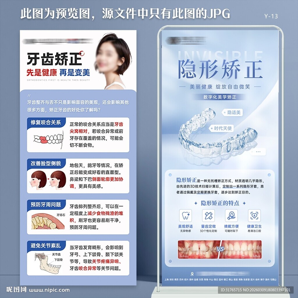 牙科口腔医院隐形矫正展架易拉宝