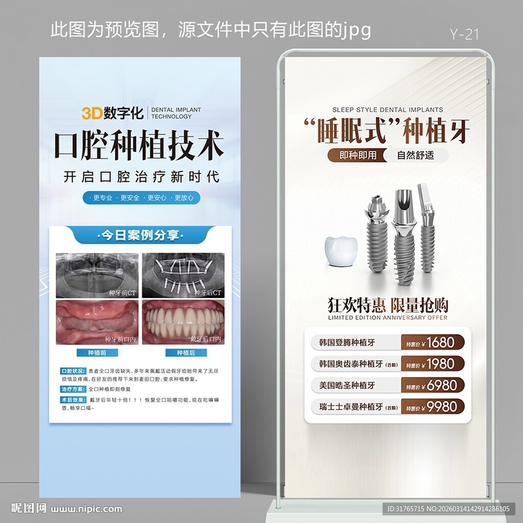 口腔种植牙对比图宣传广告展架