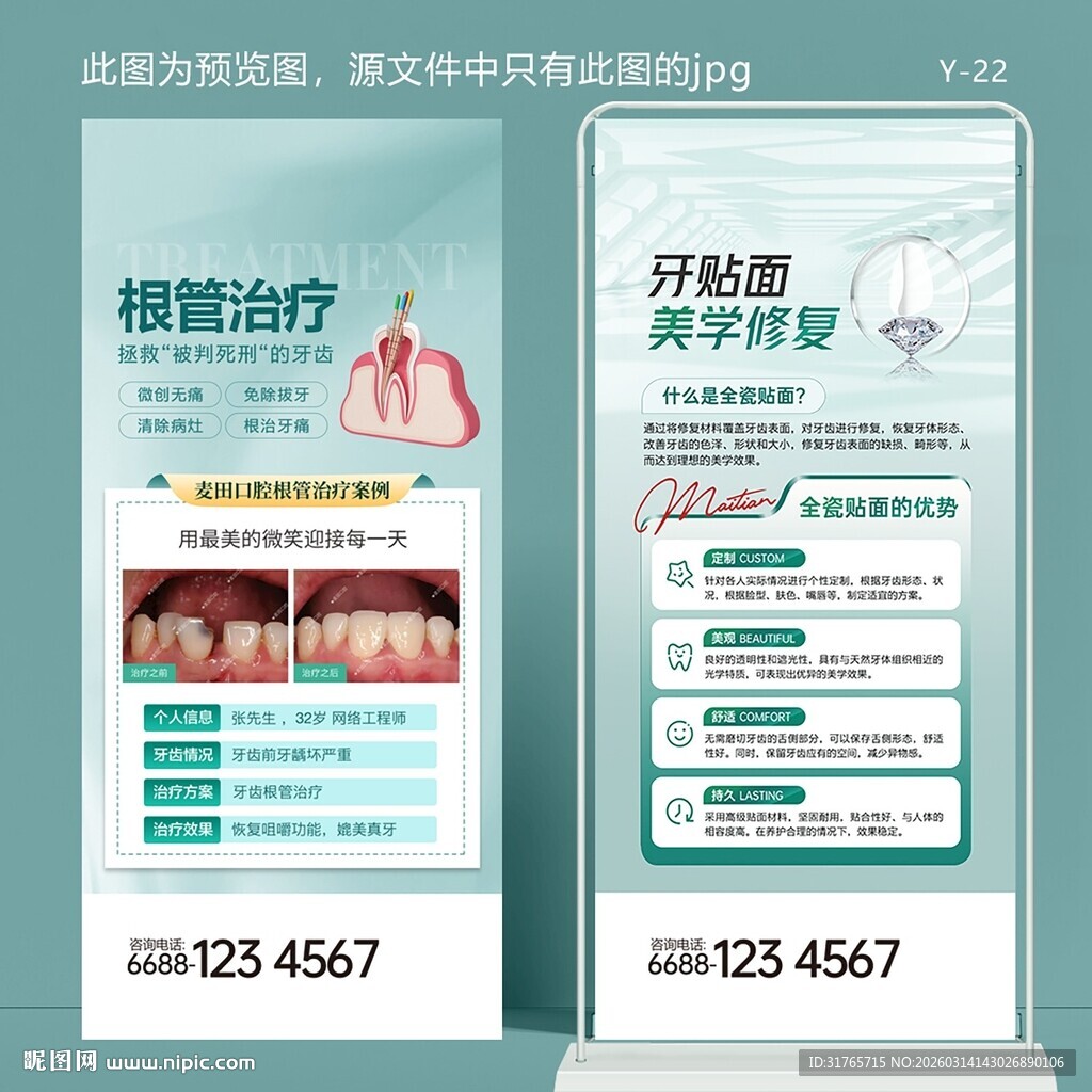 口腔根管治疗牙贴面美学修复展架