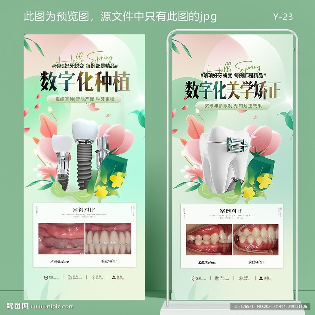 口腔数字化种植牙齿矫正展架