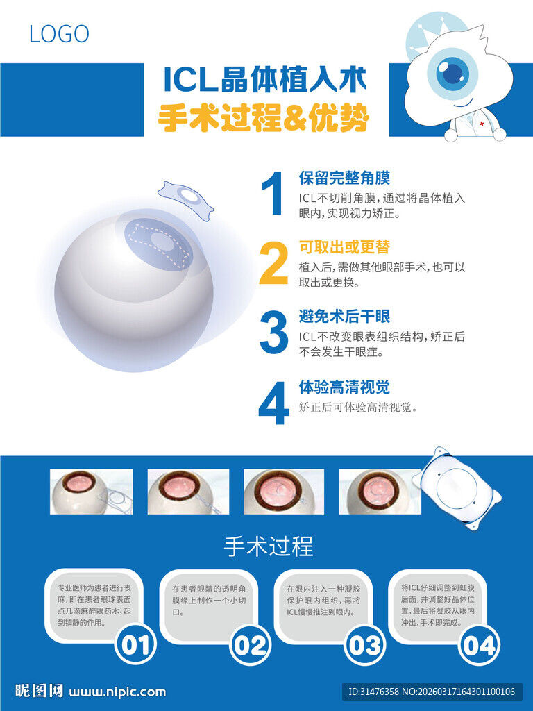 ICL晶体植入手术过程及优势
