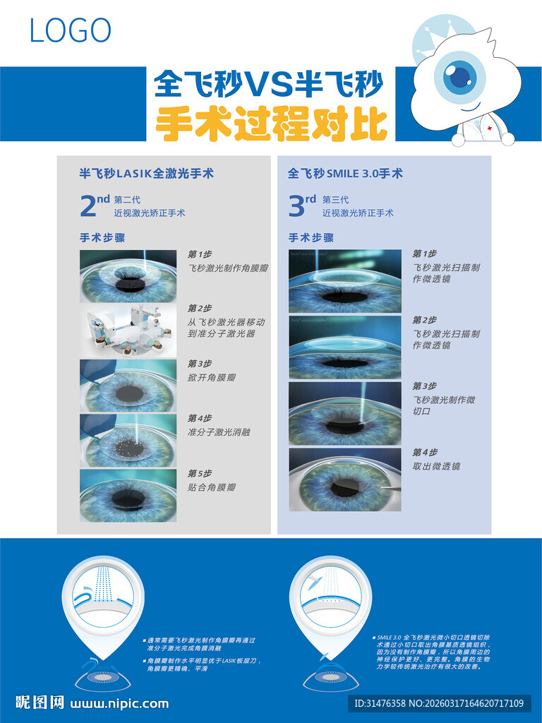 全飞秒与半飞秒手术过程对比