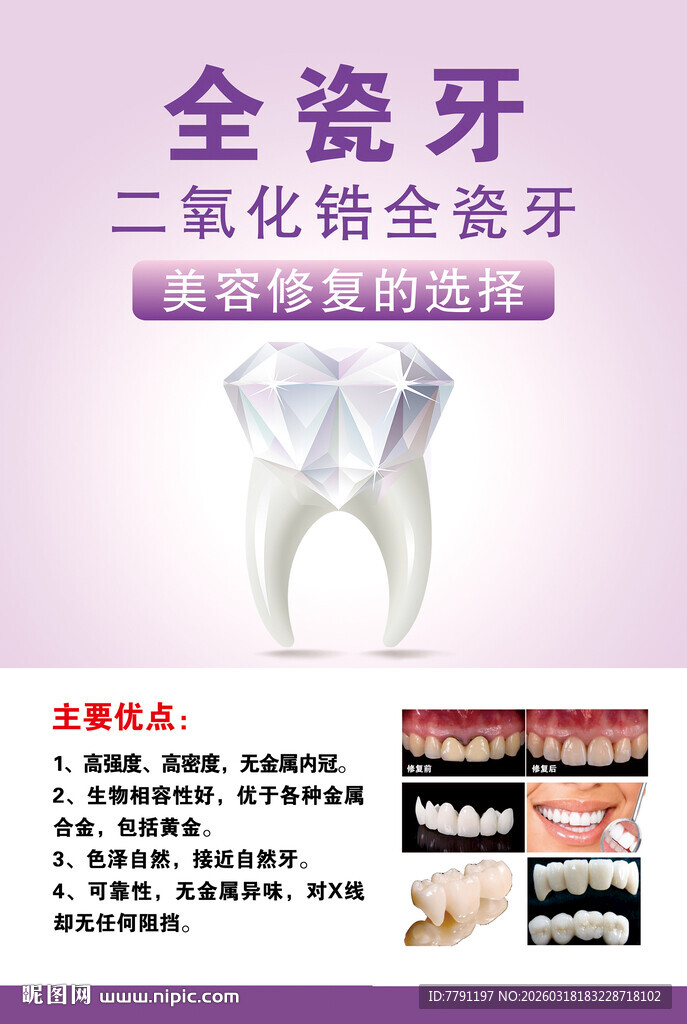 全瓷牙牙科美容海报