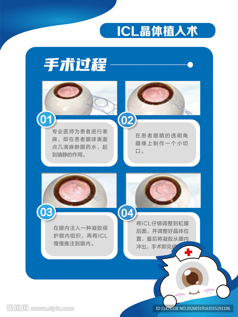 ICL晶体植入手术手术过程
