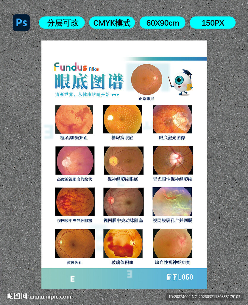 眼底图谱