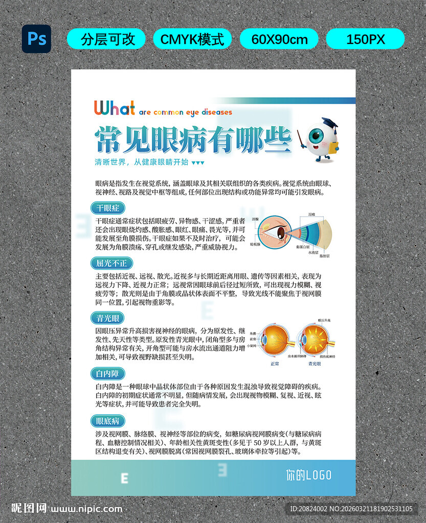 常见眼病有哪些