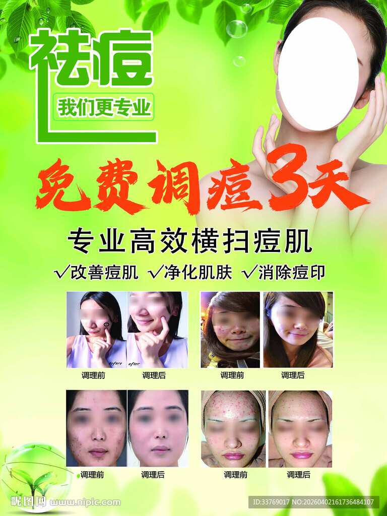 祛痘海报