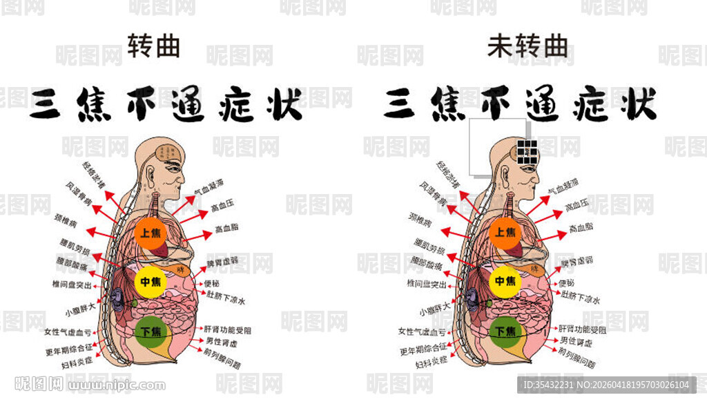 中医三焦不通症状