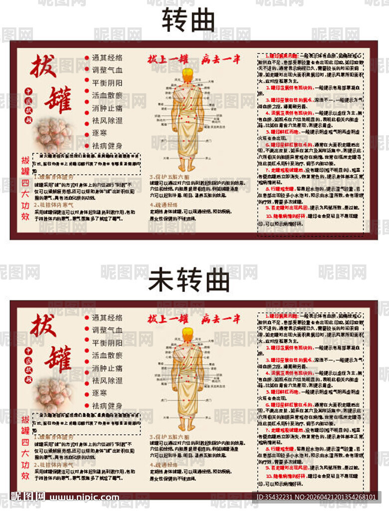 中医拔罐展板