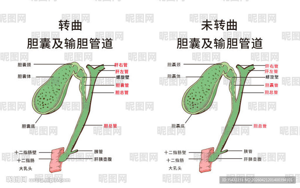 胆囊及输卵管解剖示意图