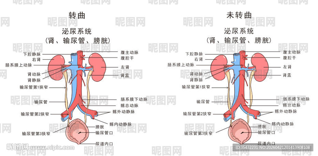 泌尿系统解剖结构示意图