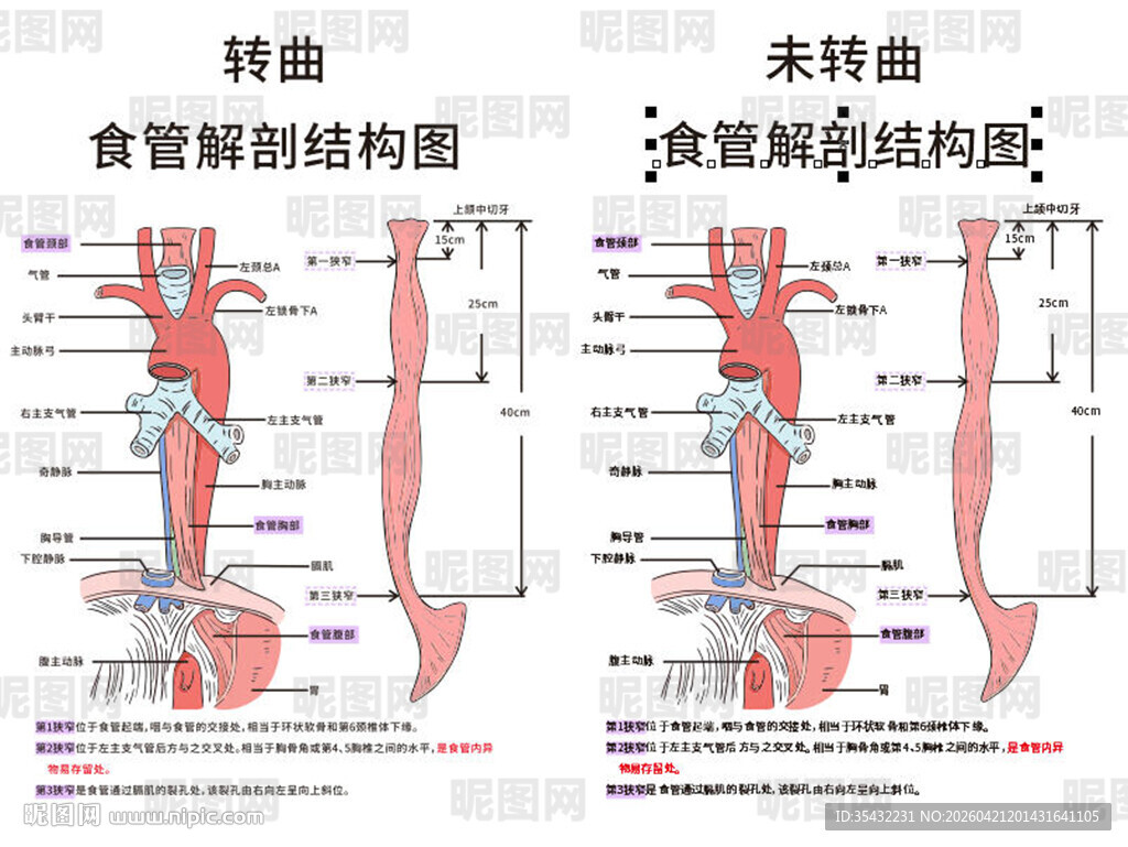 食管解剖结构对比图