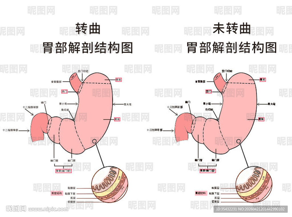 胃部解剖结构图对比