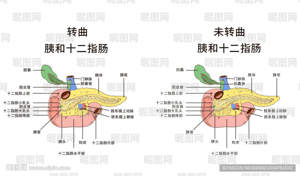 胰十二指肠解剖示意图