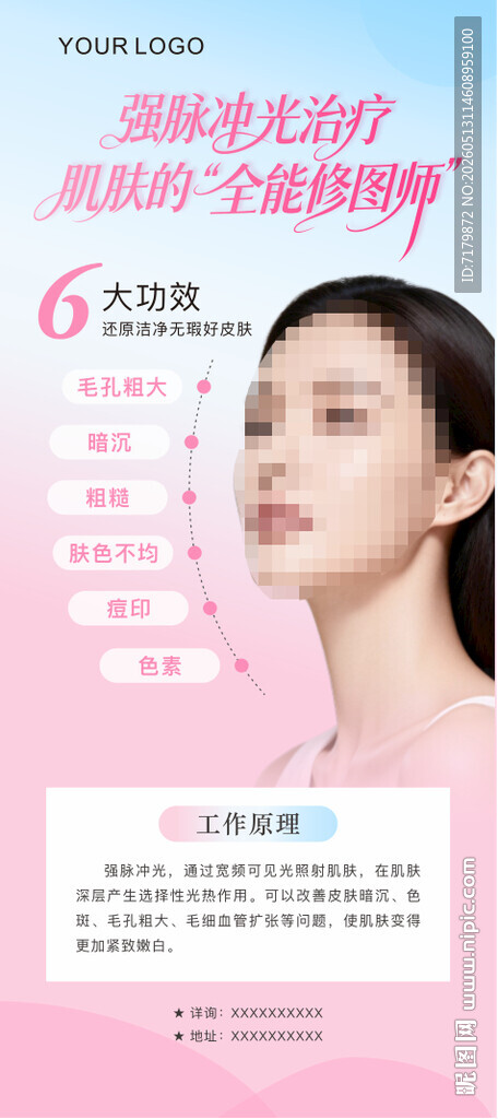 光子嫩肤