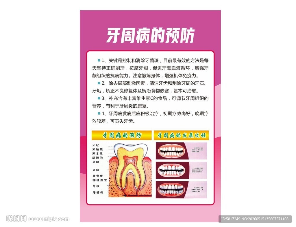 牙周病的预防