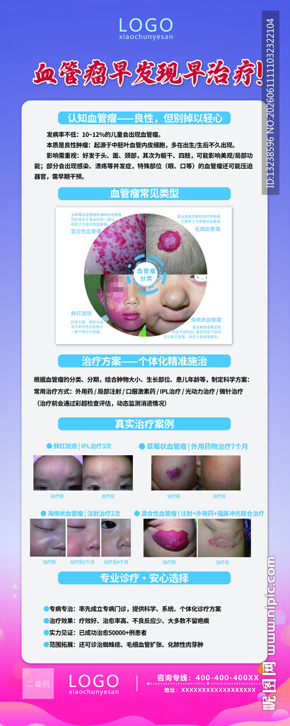 血管瘤