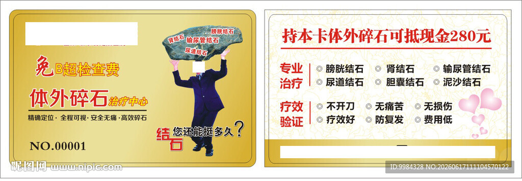 体外碎石结石诊疗优惠卡