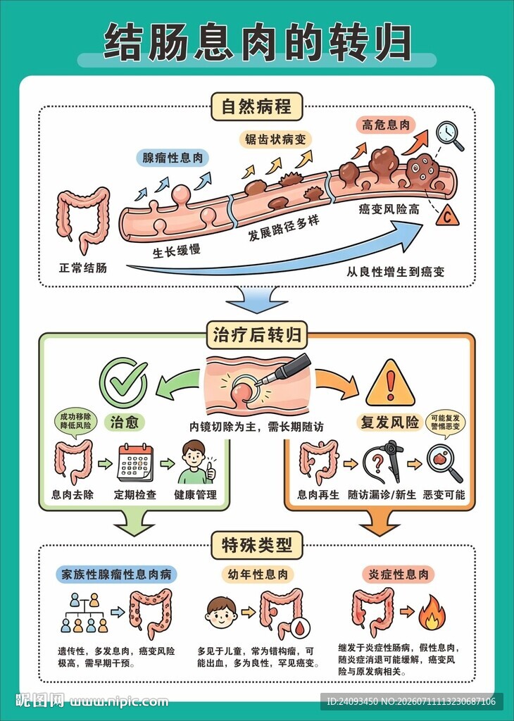 肠道息肉的转归图示