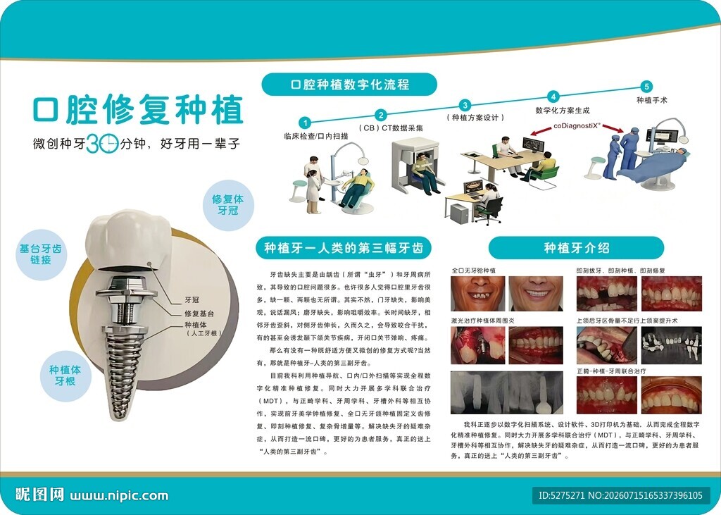 口腔修复种植