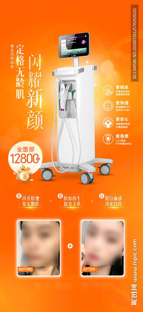 热玛吉