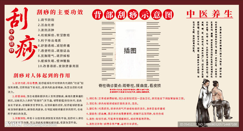 中医刮痧广告展板