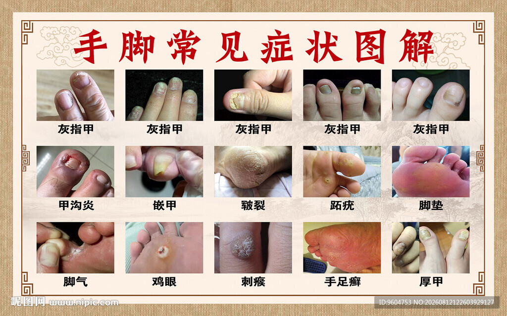 手掌常见症状图示