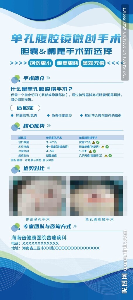 单孔腹腔镜微创手术展架
