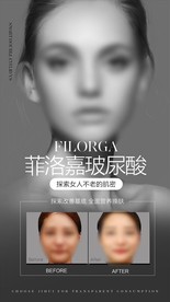 玻尿酸对比案例宣传海报