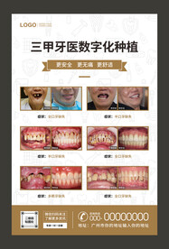 牙齿种植