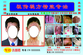 面痣 牛皮廯 甲沟炎 脚气