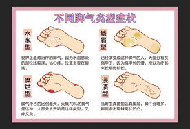 脚气类型