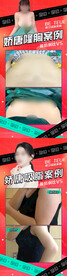 医美案例对比