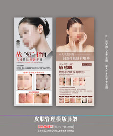 皮肤管理展架