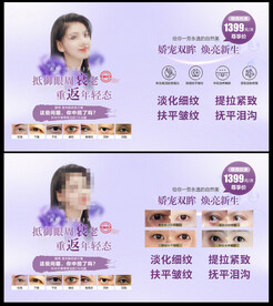 眼部抗衰