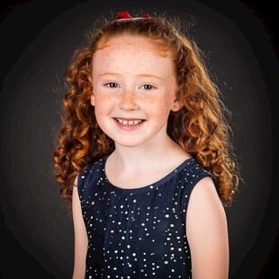 满脸雀斑的儿童