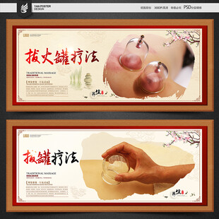 养生拔火罐