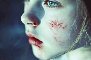 脸上带伤的忧郁少女