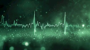 绿色动感心跳波形背景图