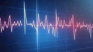 动感心跳波形图