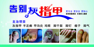 告别灰指甲 开启健康新甲