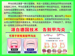 源自德国技术告别甲沟炎