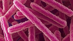 显微镜下的粉色细菌形态