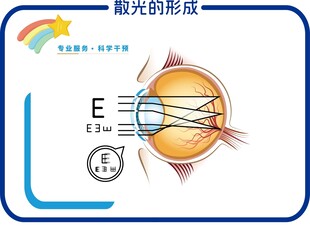 散光的形成